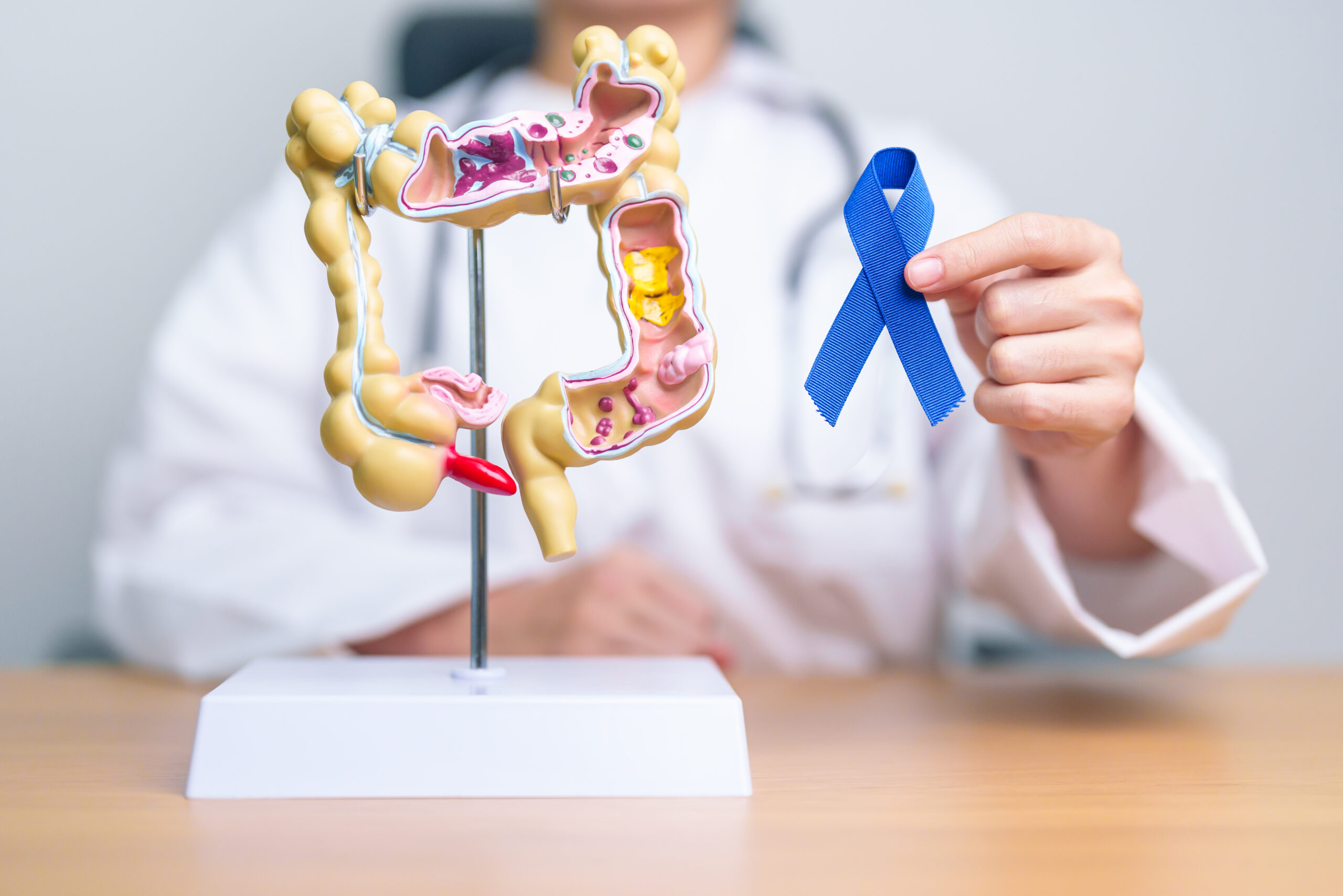 Gastrointestinal Cancer Surgeon in Vadodara