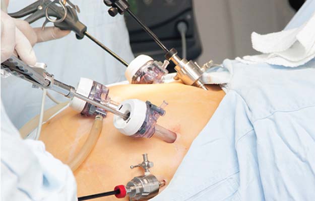 Laparoscopic Surgeon In Vadodara